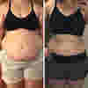 Resultados visibles de reducción de abdomen y medidas con Hot Shapers.